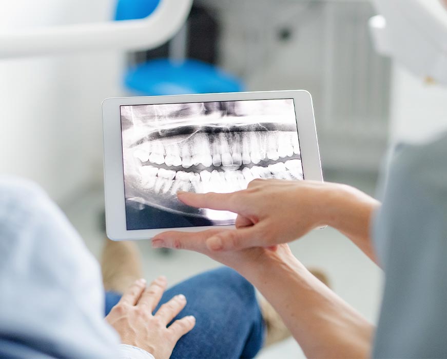 A dental professional uses a tablet to view an X-ray image of a patient s mouth.