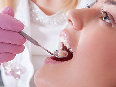 A person receiving dental care, with a dental hygienist performing a cleaning procedure using a drill and other tools.